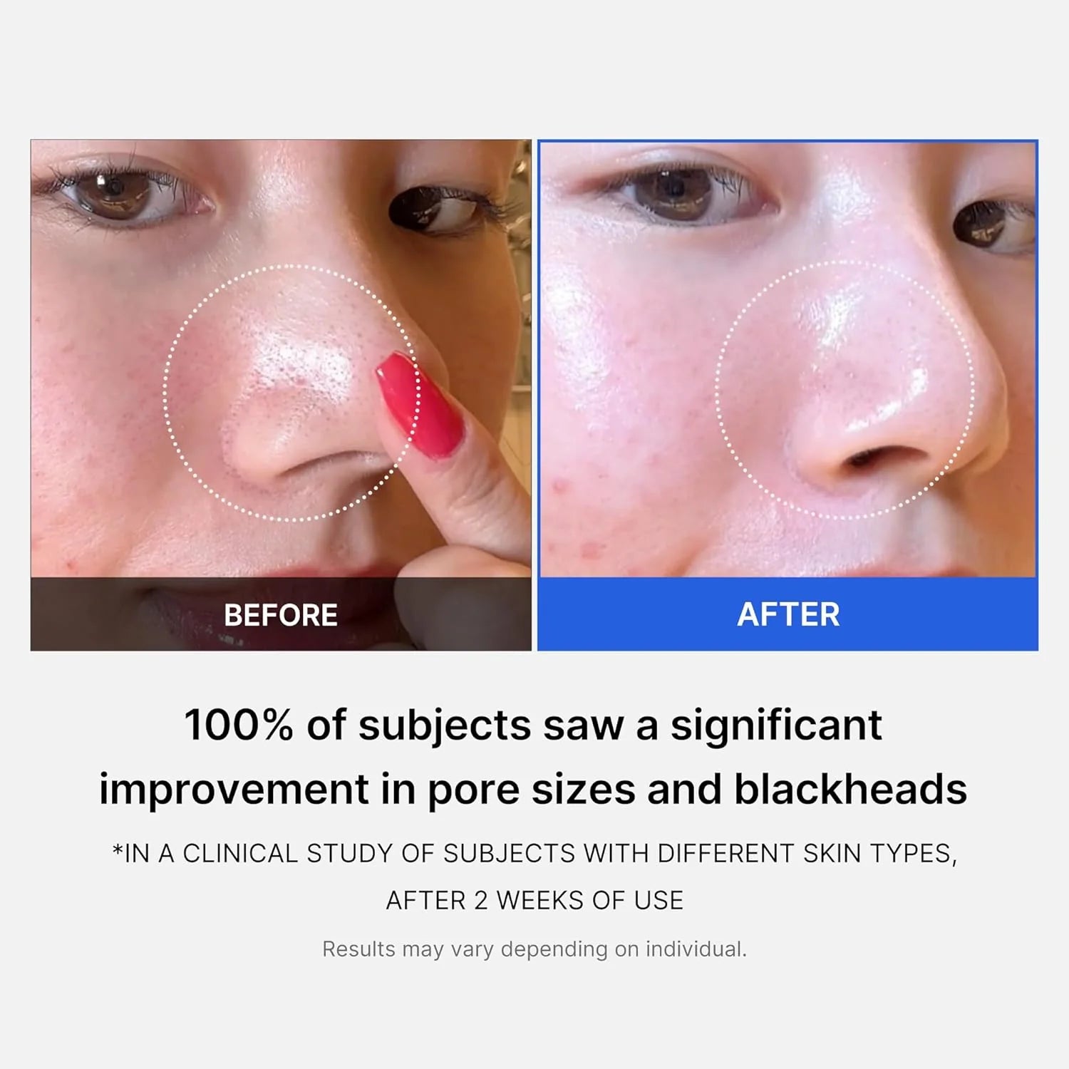 Medicube Zero Pore Pad 2.0 (70pcs) - 155g