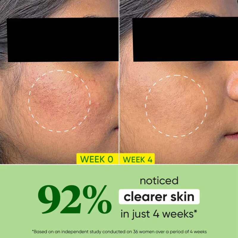 Dot & Key Cica Calming Oil Free Moisturizer 60ml - Image 6