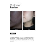 Minimalist Alpha Arbutin 2% Serum 30ml - Image 5