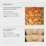 SOME BY MI Yuja Niacin Anti Blemish Cream 60ml - Image 6