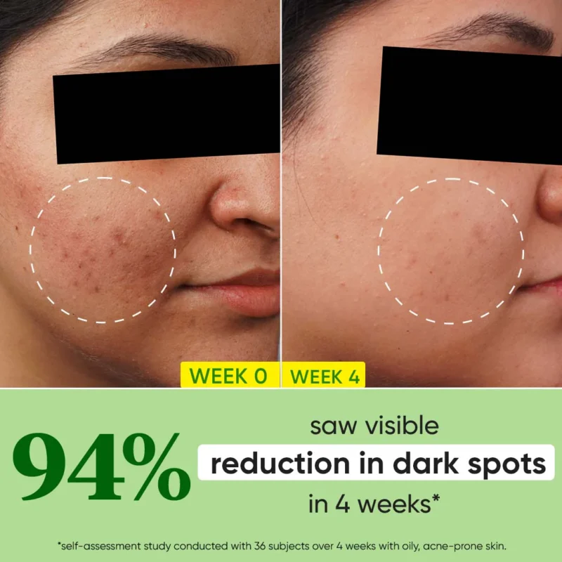 Dot & Key Cica + 10% Niacinamide Spot Reduction Face Serum 30ml - Image 5