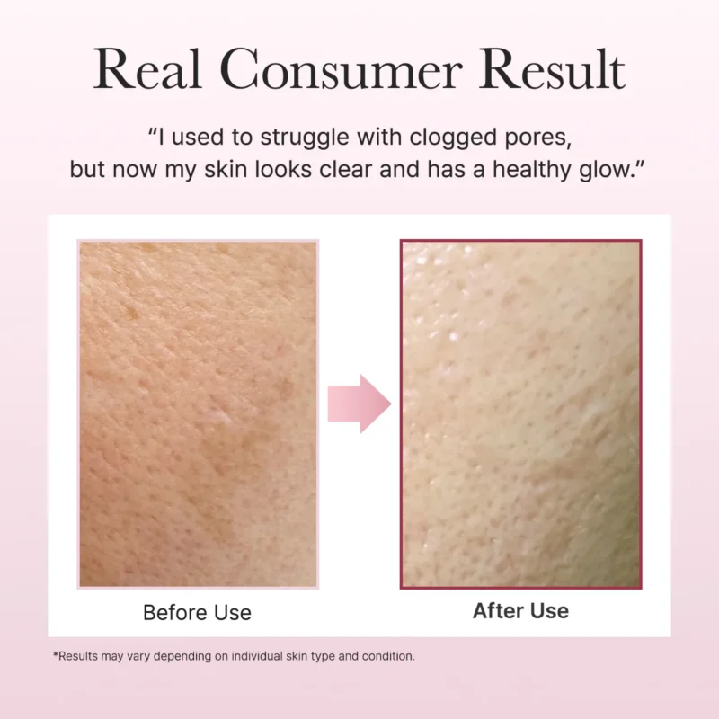 Arencia Fresh Rosehip Rice Mochi Cleanser - 120g - Image 7