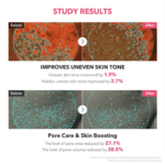 Aprilskin TXA Niacinamide Toning Shot 99 Serum - 30ml - Image 6